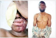 I GOT 500K FOR BATHING LAGOS SPA WORKER WITH ACID – SUSPECT